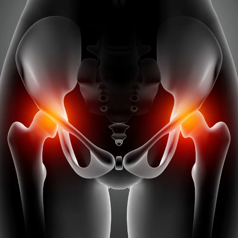 Sciatica-cat-img