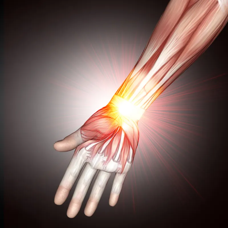 Tendinitis-cat-img