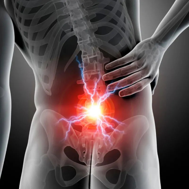 backpain-cat-img